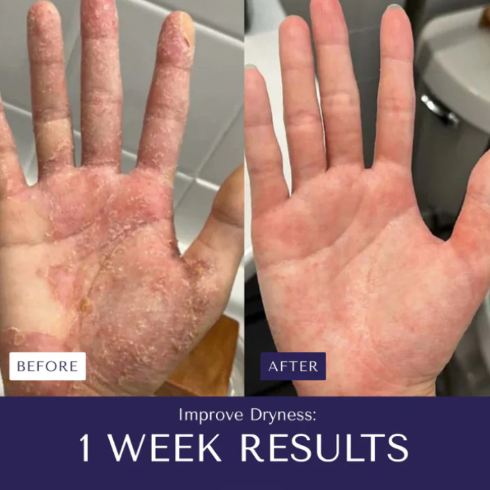 AloeMarine Relief Cream