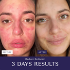 AloeMarine Relief Cream