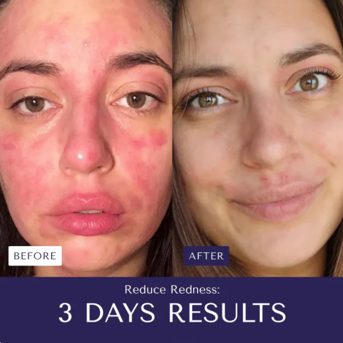 AloeMarine Relief Cream