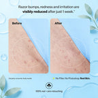 Glidr Ingrown Hair Smoothing Solution